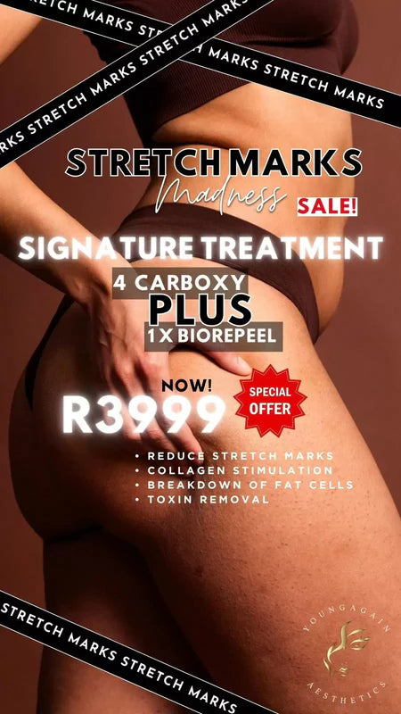 Stretchmarks signature treatments