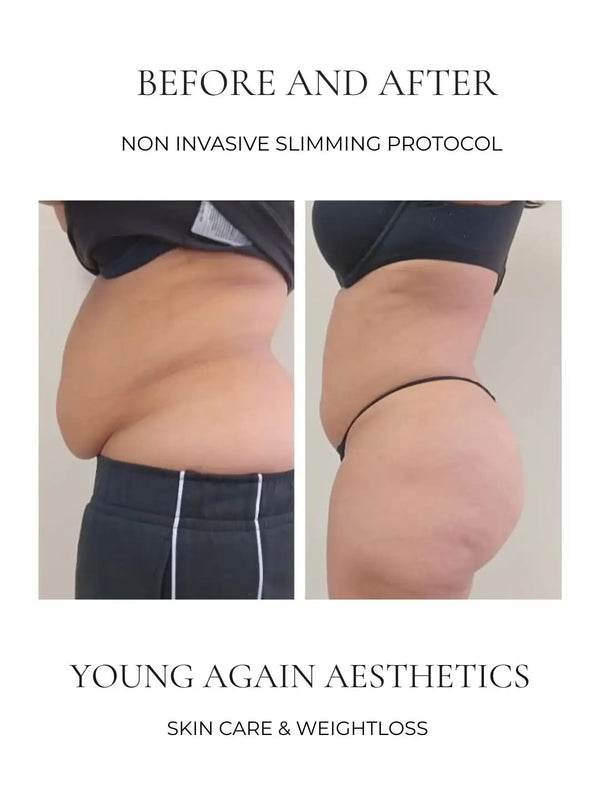 Black athletic shorts with white side stripes.