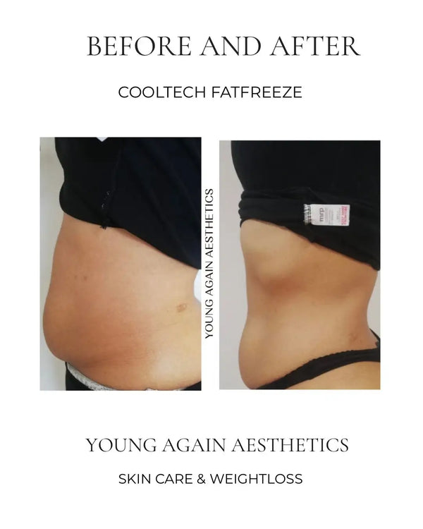 Black fabric top worn by a person showing before and after abdominal area changes.