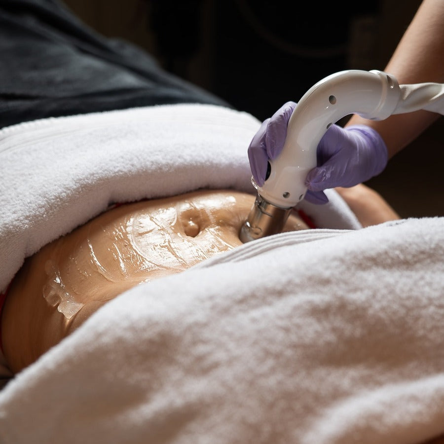 CFU Elife – Ultrasound Face & Body Lifting - Treatment