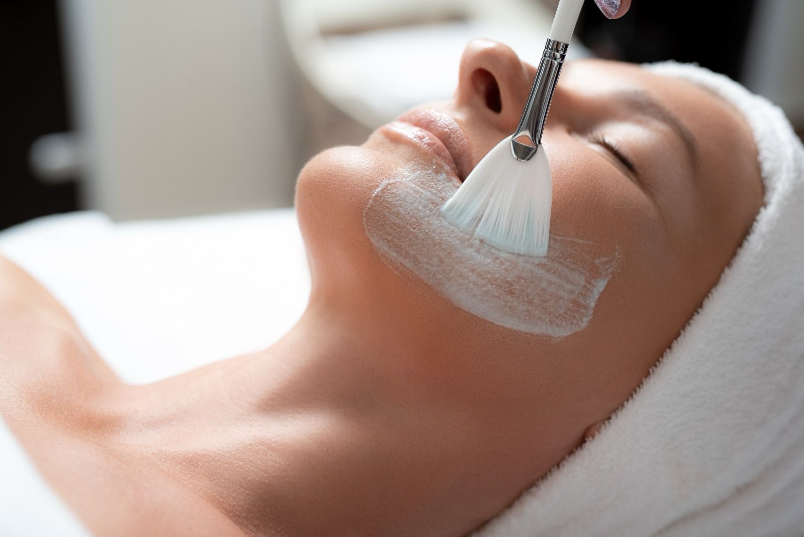 Chemical Peels - Treatment
