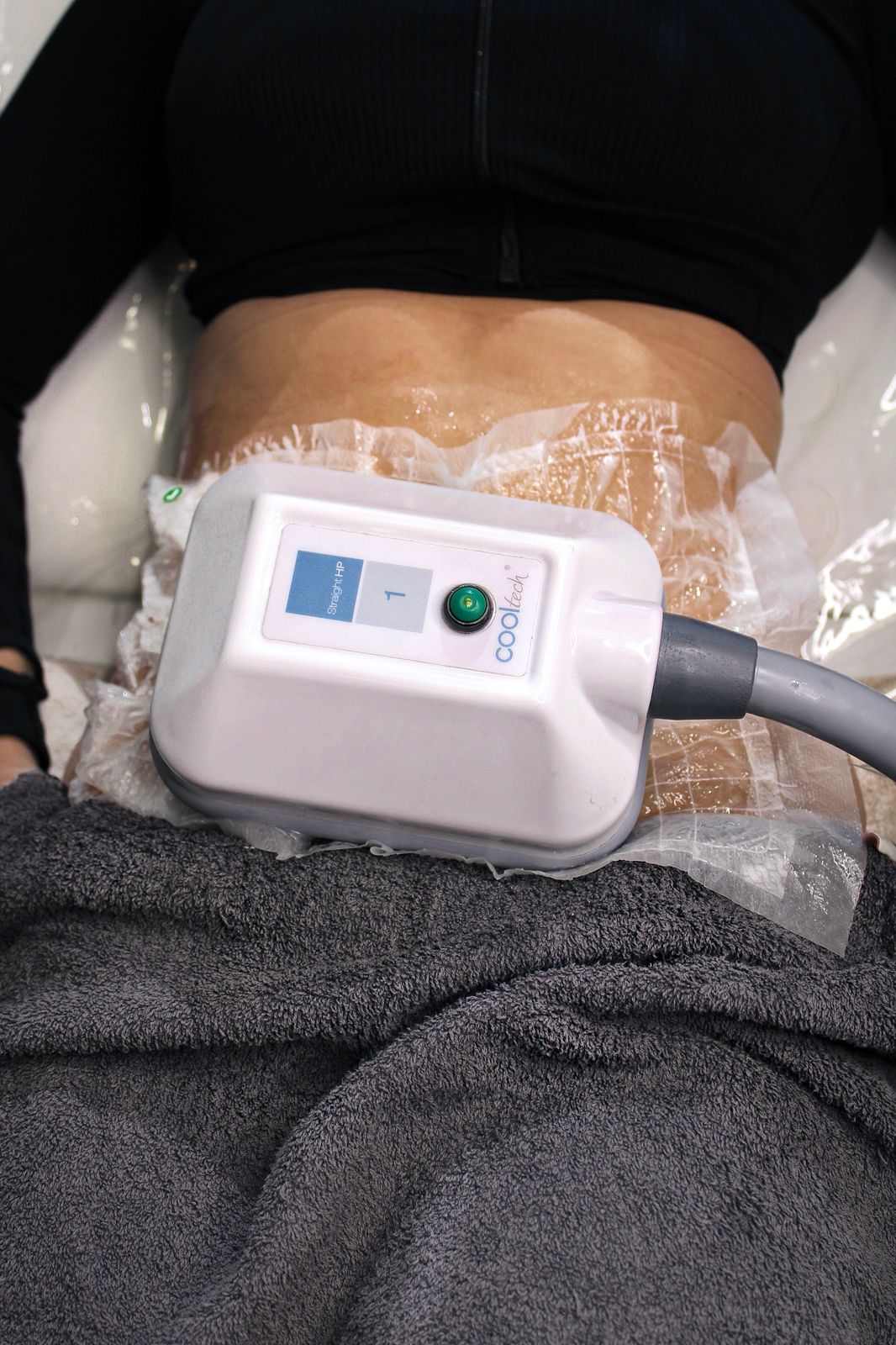 Cooltech Fatfreeze - Treatment