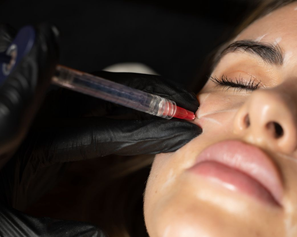 Dermal Fillers - Skin Consultation - Treatment