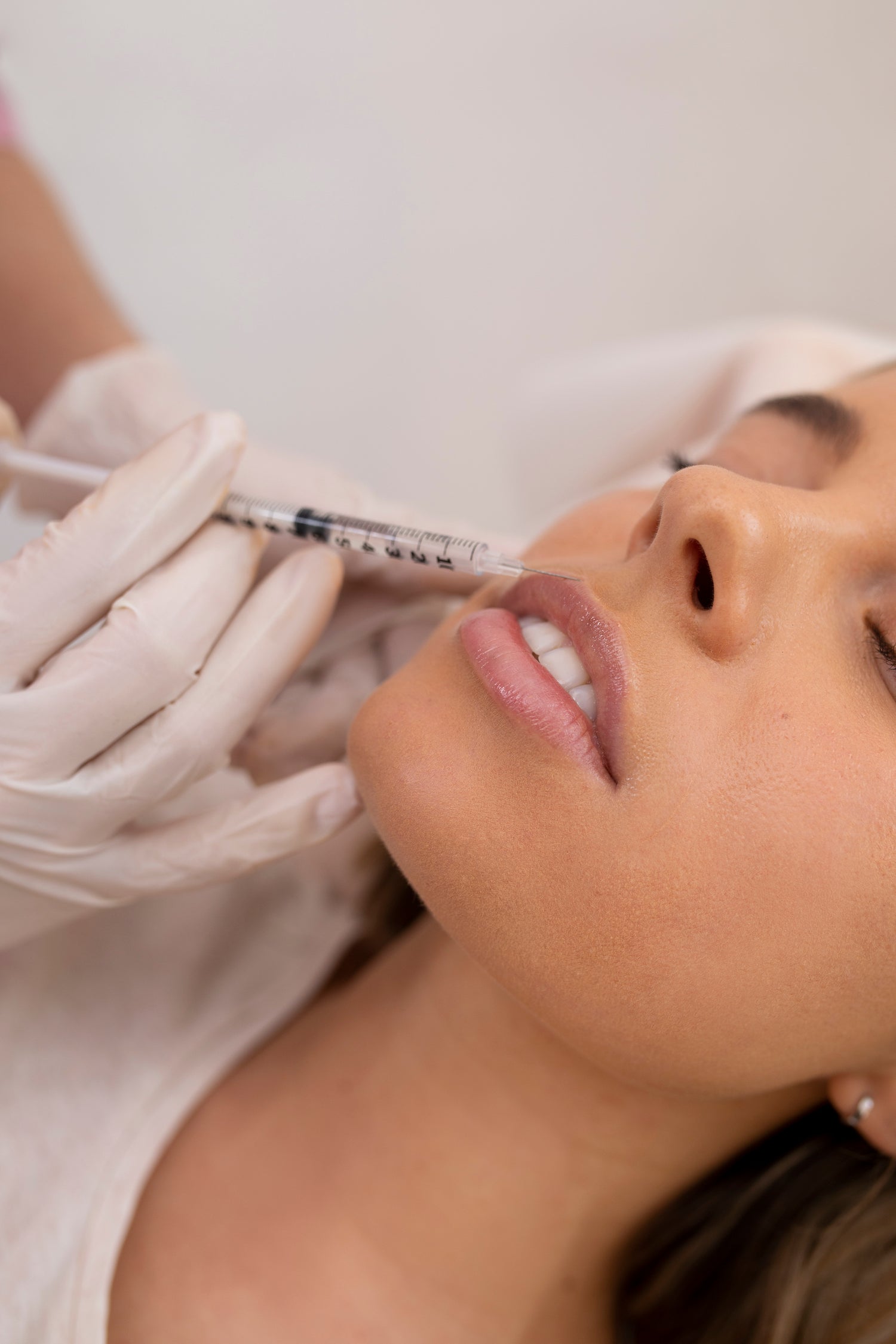 Dermal Fillers - Treatment
