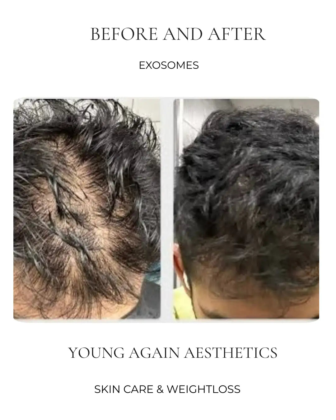 Before & After Set