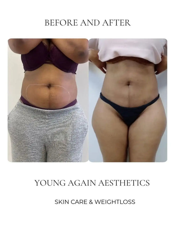 The image displays a before-and-after comparison of a person’s lower body, showing the results of skin care and weight loss treatments.