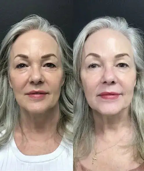 The image displays a side-by-side comparison of two portraits featuring the same woman with long, silver-gray hair and fair skin.