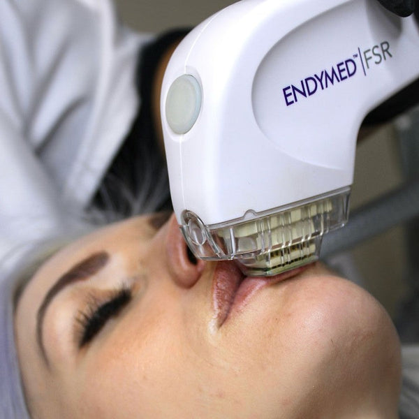 Endymed Fractional Skin Resurfacing (FSR) - Treatment