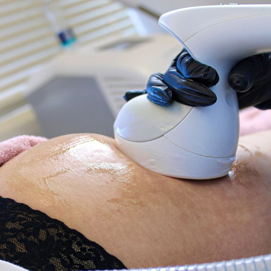 Endymed RF Body Contouring & Skin Tightening - Treatment