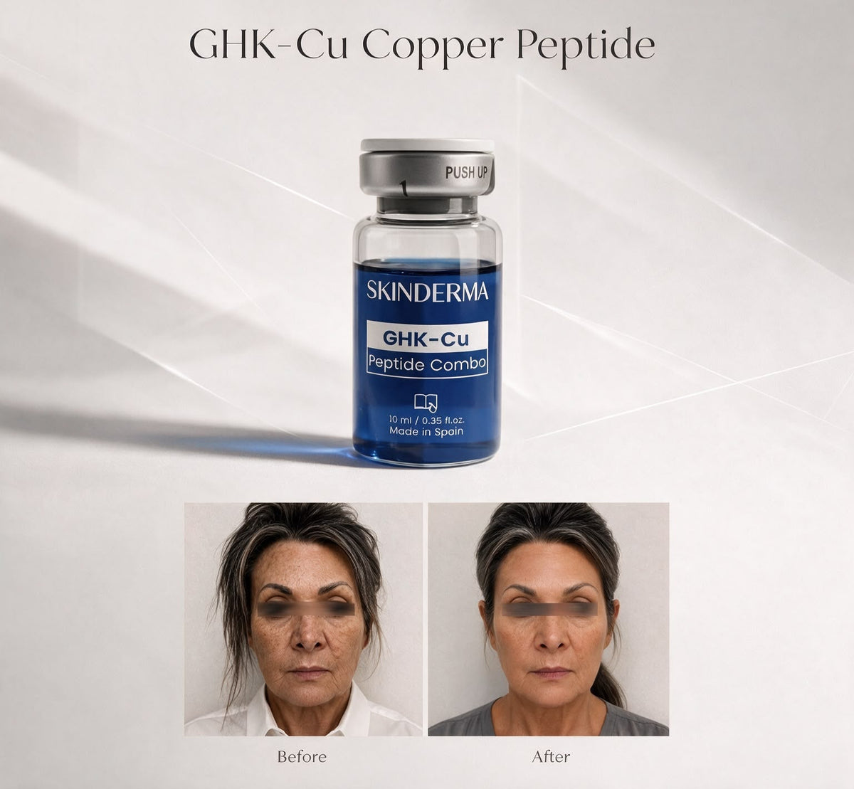GHK-Cu Peptide Combo Facial - GHK-CU Copper peptide and Microneedling - Treatment