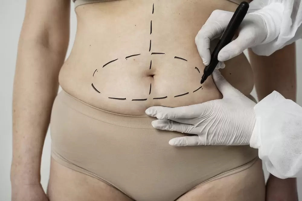 Lysiwave Non Invasive Liposuction - Treatment