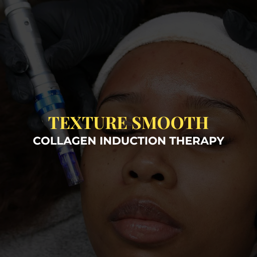 Microneedling - Treatment