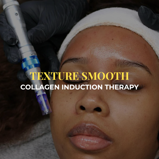 Microneedling - Treatment