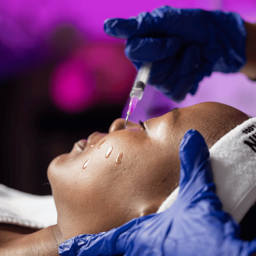 PRX Plus Bio-Revitalization: The Peel That Doesn’t Peel. - Treatment