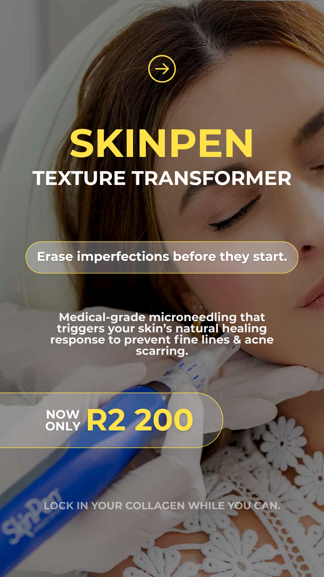 SkinPen Microneedling Special: Texture Transformer - Specials