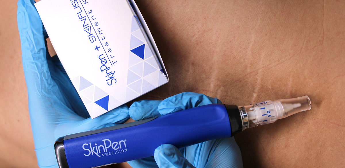 SkinPen Microneedling - Treatment