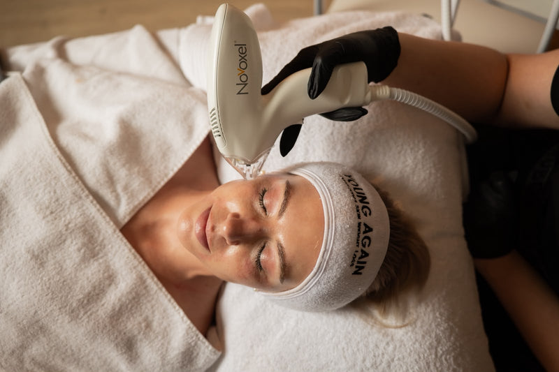 Tixel face rejuvenation at Young Again Aesthetics 