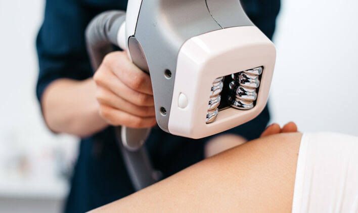 Velashape - Treatment