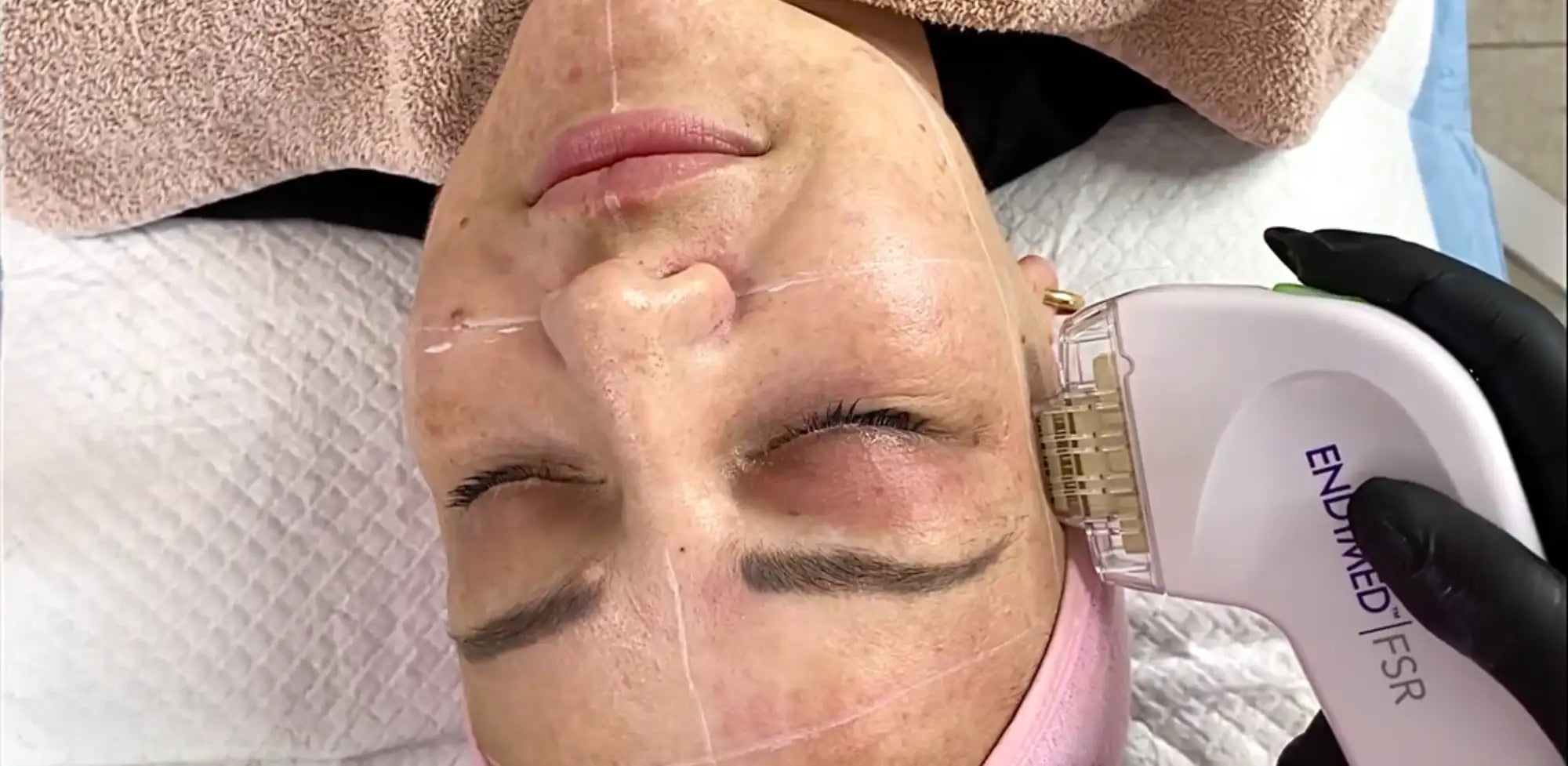 White endymed fsr skincare device with gold-tipped treatment head