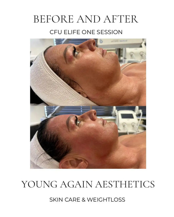 White textured headband worn by a woman during a facial treatment.