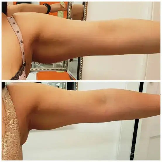 The top image shows a woman wearing light pink lace lingerie with dark brown polka dots, while the bottom image displays her in beige floral-patterned underwear.