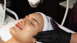 Tixel®️ Skin Rejuvenation - Treatment